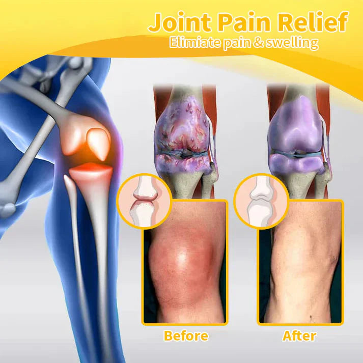 ✅Official Store: Bostore™ Bee-Venom Pain-Relief Bone Healing Cream👨⚕️Orthopaedic Association(AOA) Approved (Reducing joint swelling, pain, stiffness, redness, warmth, soreness, and joint fatigue)