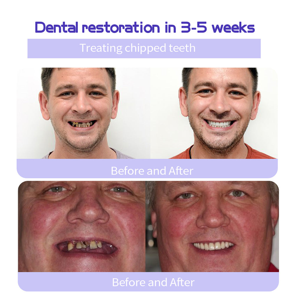 Oyikey™ Teeth Restoration Mineral Powder👩⚕️(ADA recommended)Last Day Discount🔥