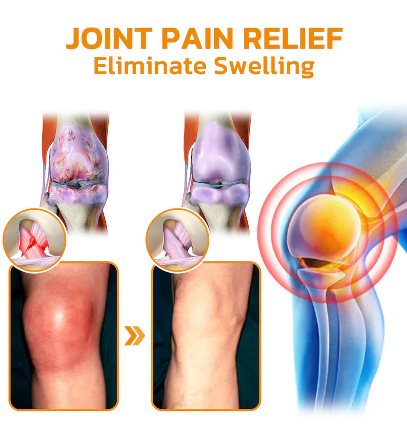 ✅Official Store: Bostore™ Bee-Venom Pain-Relief Bone Healing Cream👨⚕️Orthopaedic Association(AOA) Approved (Reducing joint swelling, pain, stiffness, redness, warmth, soreness, and joint fatigue)