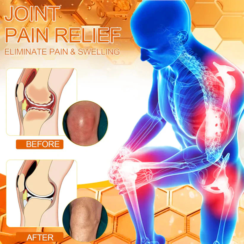 ✅Official Store: Bostore™ Bee-Venom Pain-Relief Bone Healing Cream👨⚕️Orthopaedic Association(AOA) Approved (Reducing joint swelling, pain, stiffness, redness, warmth, soreness, and joint fatigue)