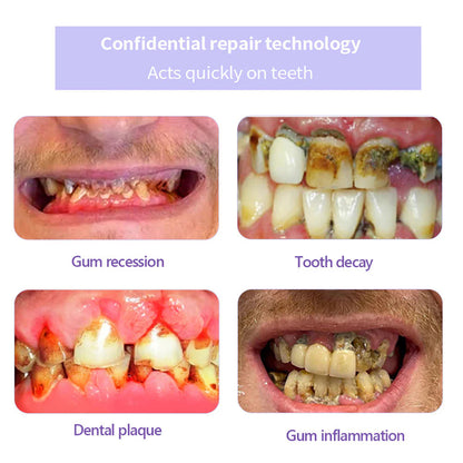 Oyikey™ Teeth Restoration Mineral Powder👩‍⚕️(ADA recommended)Last Day Discount🔥